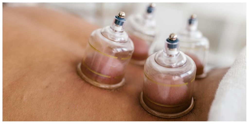 Cupping Therapy: What You Should Know About Its Benefits